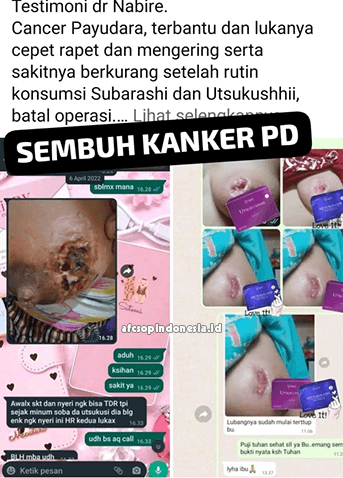 Testimoni Produk Subarashi - 4